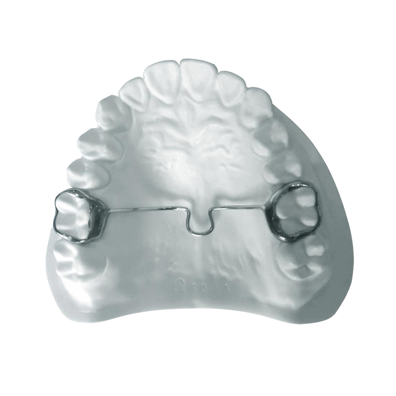 Fixed Transpalatal Arch (TPA)