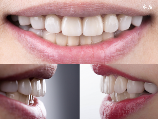 Kina dental lab produksjonsteknologi av zirconia lang bro