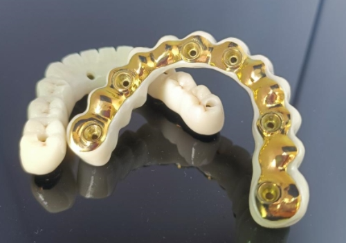 CAD/CAM Titanium Implant Bar+Zirconia Bridge