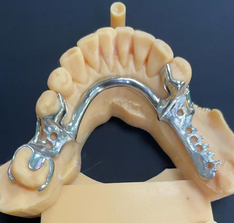 Fordeler med Cobalt-Chromium Framework (Co Cr Framework)