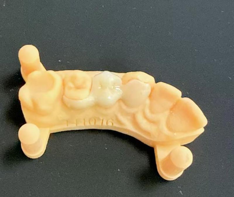 Hva du trenger å vite om Maryland Bridges?