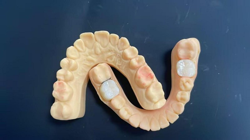 Hva er skulderkanten?