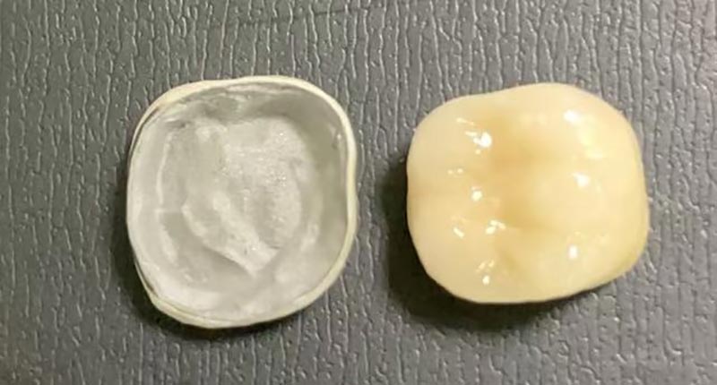 WM DENTAL LAB – Et ledende kinesisk tannlaboratorium