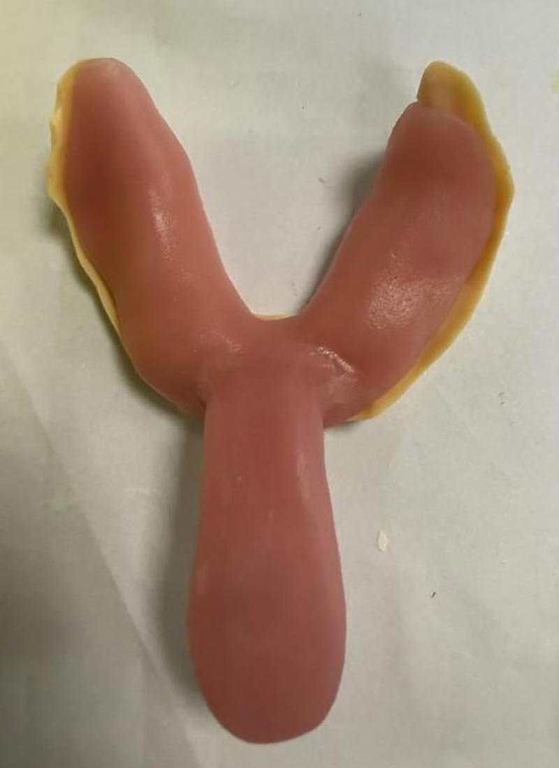 Ting du ikke visste om tilpassede tannbrett