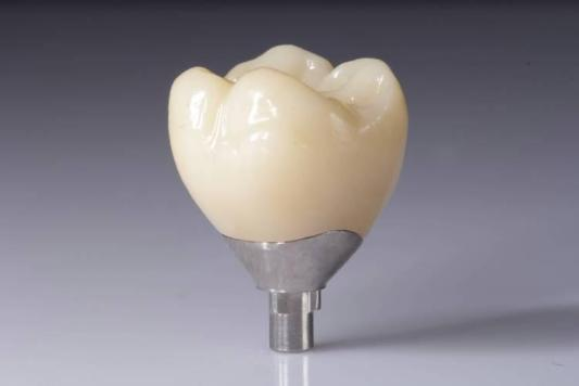 Optimaliser resultatene dine med Zirconia-restaureringer (kroner, broer, implantater)