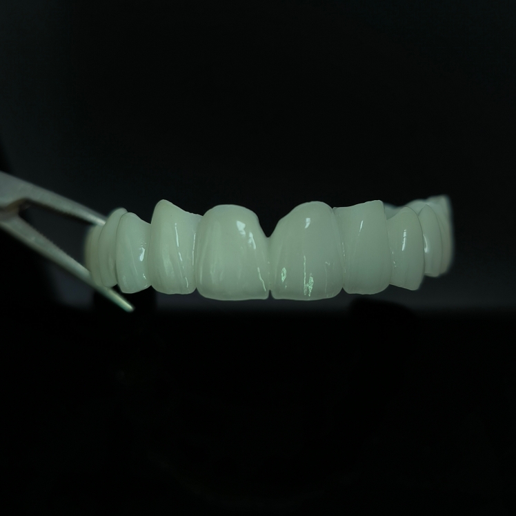 High Translucent Zirconia Bridge Layered Zirconia Kina Dental lab arbeid