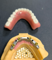 Locator og tannstang