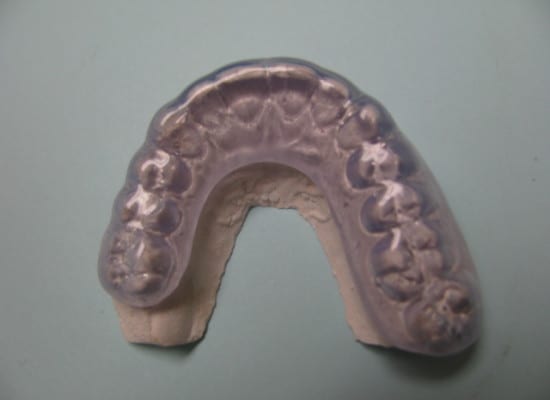 Okklusal brace