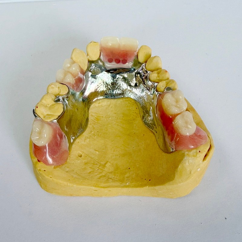 Fjernbar restaurering delvis rammeverk